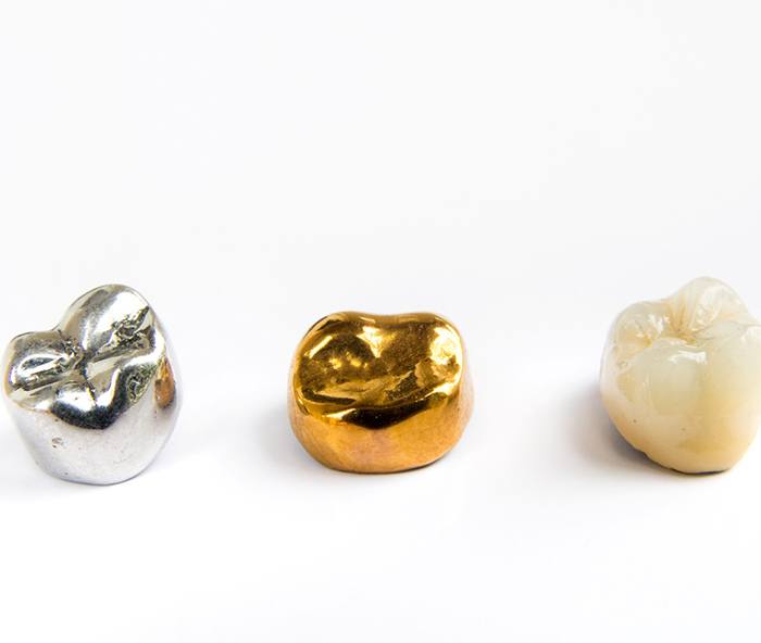 Three different types of dental crowns