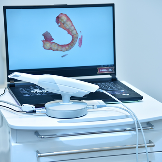 Digital impression of teeth on computer monitor