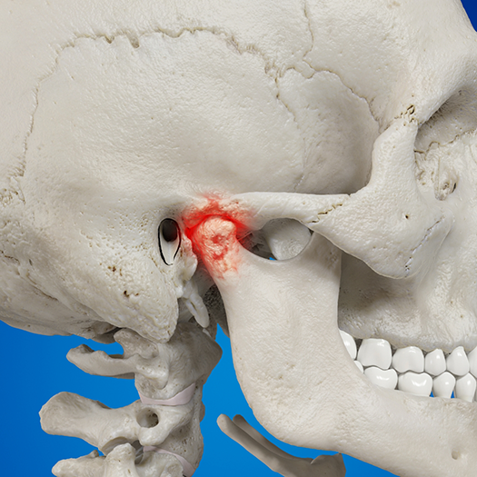Illustration of TMJ on skull