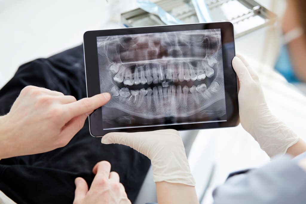 Hands holding digital tablet with dental X-rays displayed